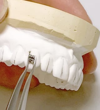Mini Brackets